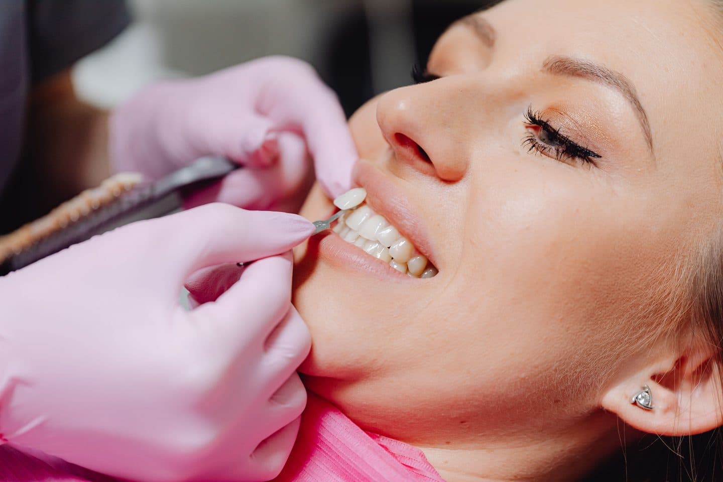 A close-up of a dentist placing a veneer against a patient's tooth