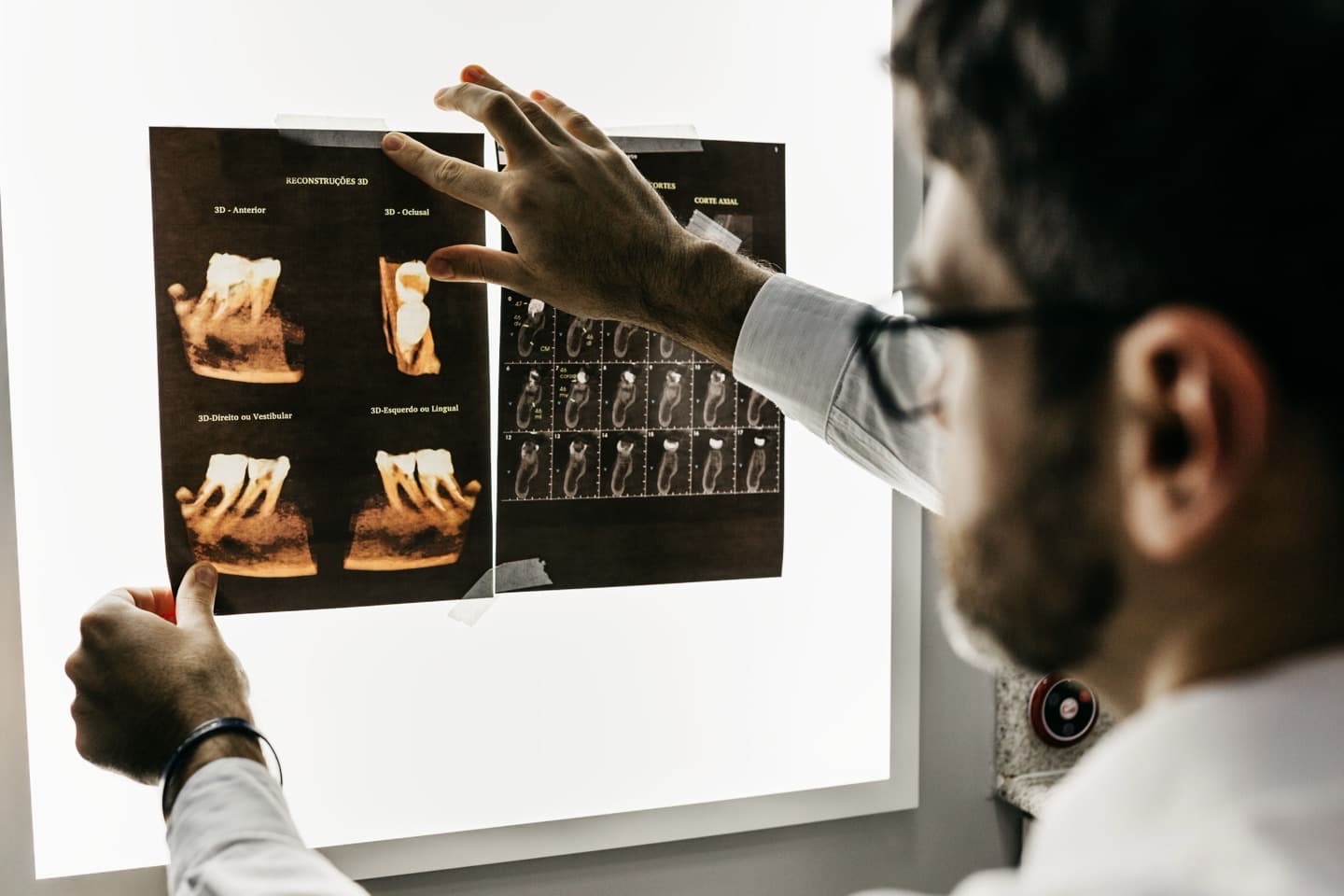 A dentist examining digital dental images on a lightbox
