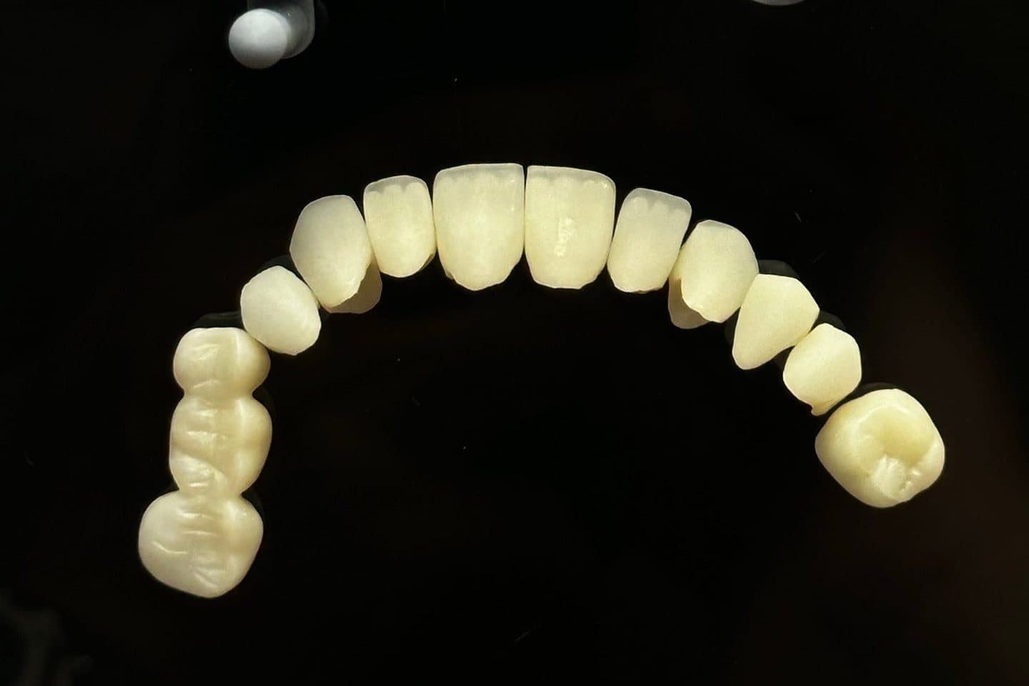 A close-up of a set of dental crowns against a black background