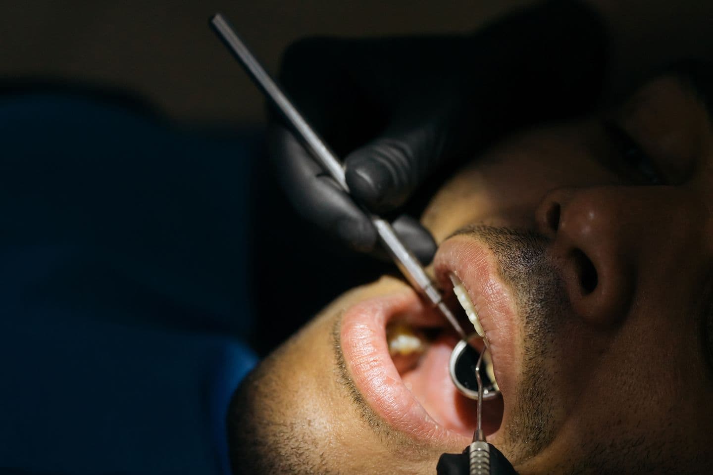 Dental Check-Up