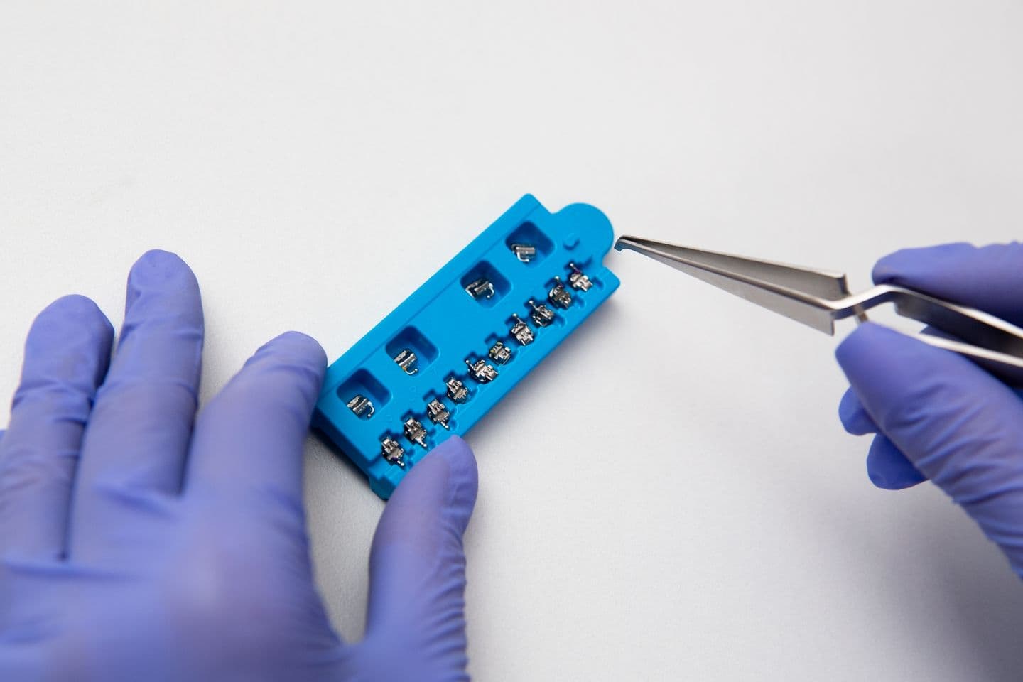 Orthodontics (Braces)